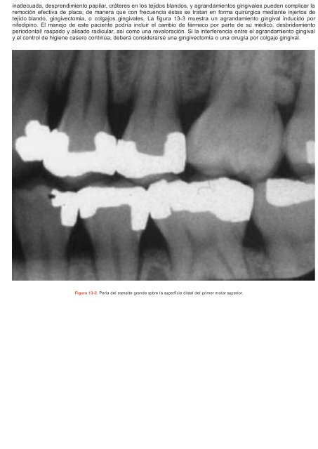 Periodoncia.e.Implantologia.Dental.de.Hall