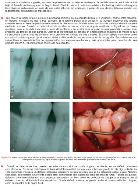 Periodoncia.e.Implantologia.Dental.de.Hall