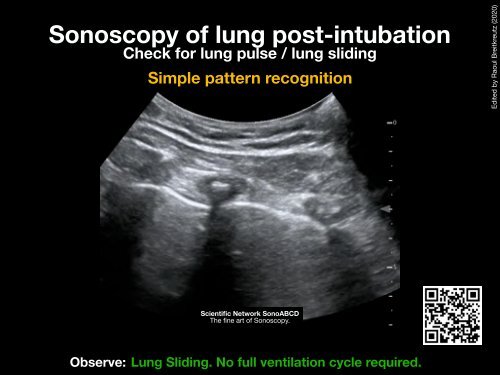 Resuscitation Ultrasound