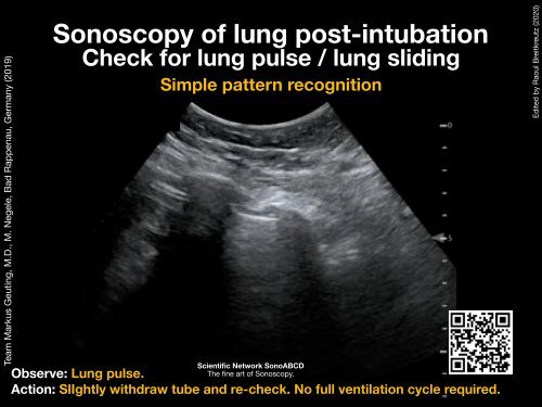 Resuscitation Ultrasound