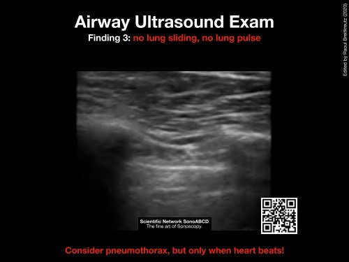 resus ultrasound