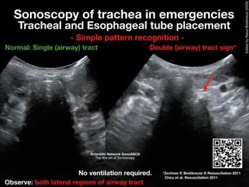 Resuscitation Ultrasound