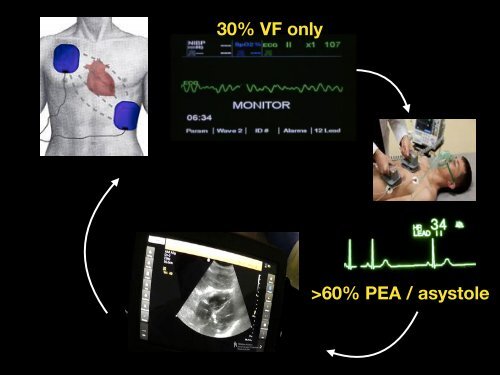 Resuscitation Ultrasound