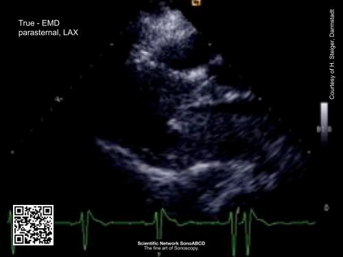 Resuscitation Ultrasound