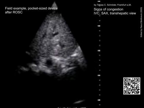 Resuscitation Ultrasound