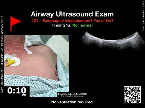 Resuscitation Ultrasound