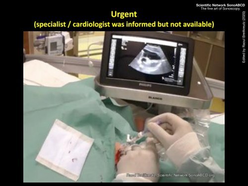 Resuscitation Ultrasound