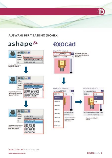 TITANBASIS NX