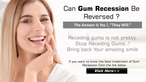 Reverse Receding Gums 