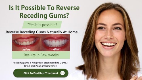 How To Reverse Receding Gums At Home