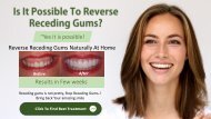 How To Reverse Receding Gums At Home?