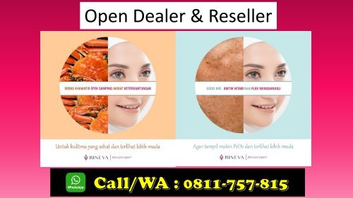 PROMO, TELP/WA 0811-757-815, Skincare Yang Bagus RINEVA