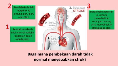 KAUNSELING PESAKIT warfarin