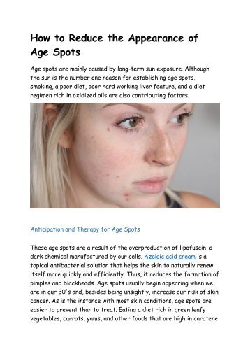 How to Reduce the Appearance of Age Spots