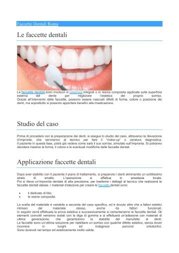 faccette-dentali-roma