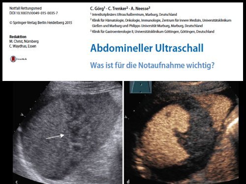 CEUS bei Abdominaltrauma?