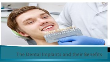 The Dental Implants and their Benefits