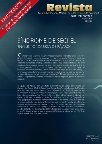 SUPL 1 SINDROME DE SECKEL  VOL 16 N3 2013