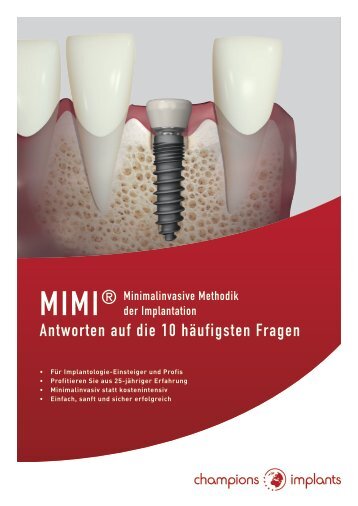 10 Fragen und Antworten zum minimal-invasiven Insertionsprotokoll "MIMI"