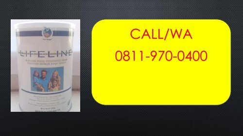 DISTRIBUTOR, CALL/WA 0811-9700-400, Merk Susu Untuk Kesehatan Gigi LIFELINE Madiun