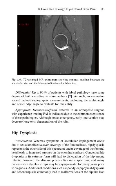 Brian P. Jacob, David C. Chen, Bruce Ramshaw, Shirin Towfigh (eds.) - The SAGES Manual of Groin Pain-Springer International Publishing (2016)