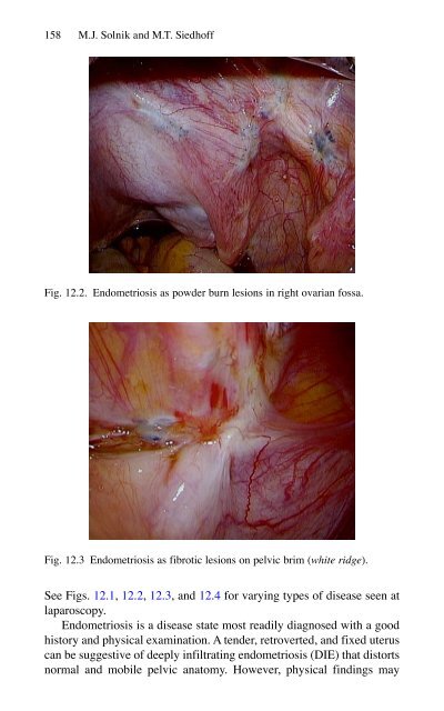 Brian P. Jacob, David C. Chen, Bruce Ramshaw, Shirin Towfigh (eds.) - The SAGES Manual of Groin Pain-Springer International Publishing (2016)