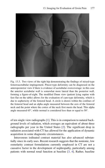 Brian P. Jacob, David C. Chen, Bruce Ramshaw, Shirin Towfigh (eds.) - The SAGES Manual of Groin Pain-Springer International Publishing (2016)