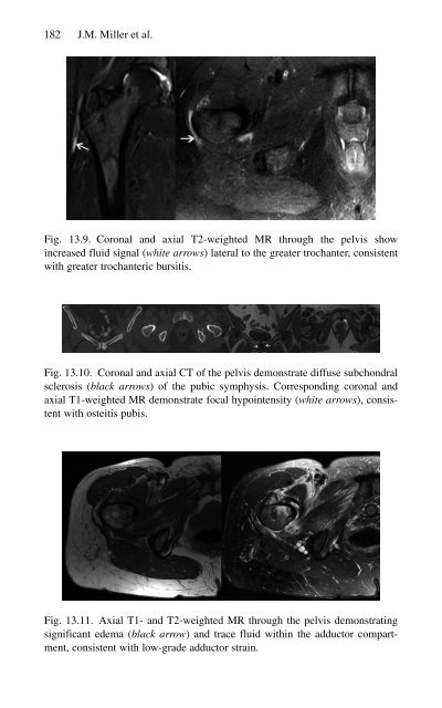 Brian P. Jacob, David C. Chen, Bruce Ramshaw, Shirin Towfigh (eds.) - The SAGES Manual of Groin Pain-Springer International Publishing (2016)