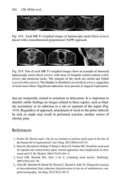 Brian P. Jacob, David C. Chen, Bruce Ramshaw, Shirin Towfigh (eds.) - The SAGES Manual of Groin Pain-Springer International Publishing (2016)