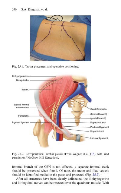 Brian P. Jacob, David C. Chen, Bruce Ramshaw, Shirin Towfigh (eds.) - The SAGES Manual of Groin Pain-Springer International Publishing (2016)