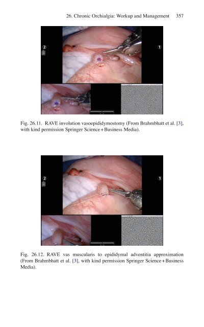 Brian P. Jacob, David C. Chen, Bruce Ramshaw, Shirin Towfigh (eds.) - The SAGES Manual of Groin Pain-Springer International Publishing (2016)