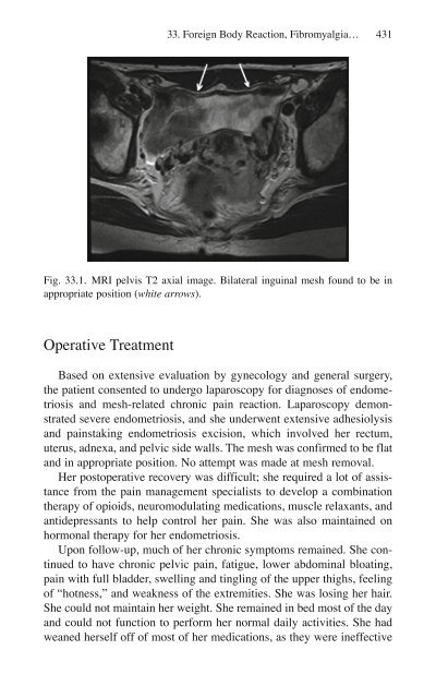 Brian P. Jacob, David C. Chen, Bruce Ramshaw, Shirin Towfigh (eds.) - The SAGES Manual of Groin Pain-Springer International Publishing (2016)