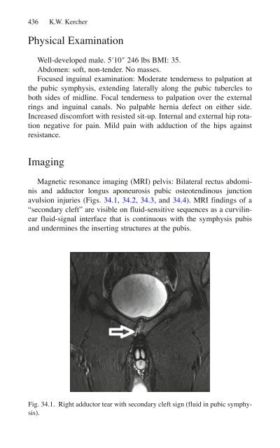 Brian P. Jacob, David C. Chen, Bruce Ramshaw, Shirin Towfigh (eds.) - The SAGES Manual of Groin Pain-Springer International Publishing (2016)