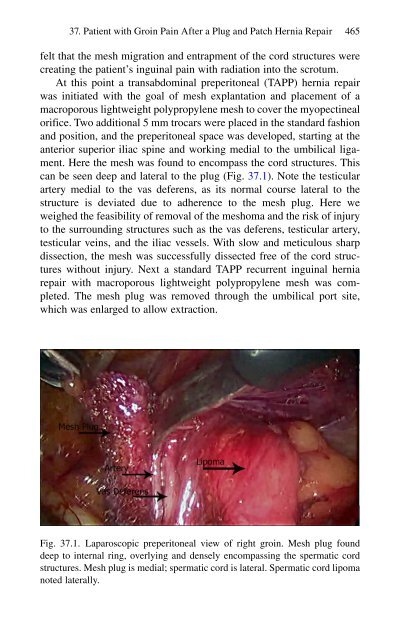 Brian P. Jacob, David C. Chen, Bruce Ramshaw, Shirin Towfigh (eds.) - The SAGES Manual of Groin Pain-Springer International Publishing (2016)