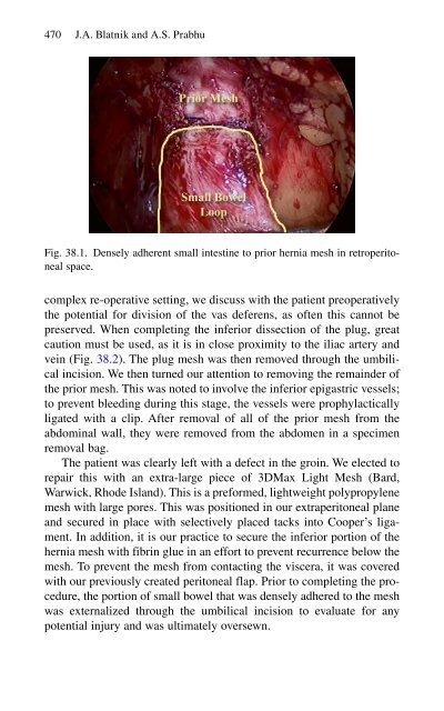 Brian P. Jacob, David C. Chen, Bruce Ramshaw, Shirin Towfigh (eds.) - The SAGES Manual of Groin Pain-Springer International Publishing (2016)