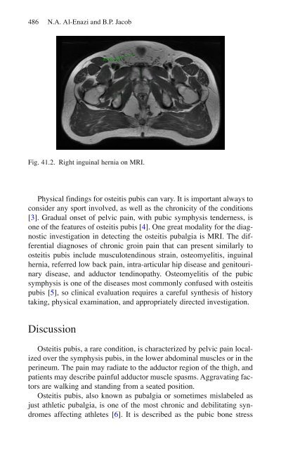 Brian P. Jacob, David C. Chen, Bruce Ramshaw, Shirin Towfigh (eds.) - The SAGES Manual of Groin Pain-Springer International Publishing (2016)