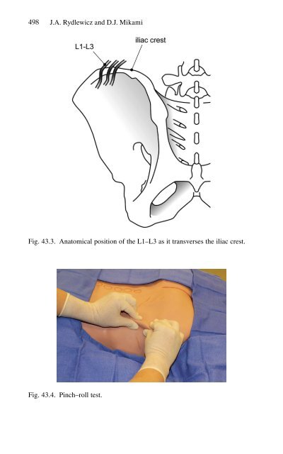 Brian P. Jacob, David C. Chen, Bruce Ramshaw, Shirin Towfigh (eds.) - The SAGES Manual of Groin Pain-Springer International Publishing (2016)