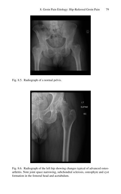 Brian P. Jacob, David C. Chen, Bruce Ramshaw, Shirin Towfigh (eds.) - The SAGES Manual of Groin Pain-Springer International Publishing (2016)