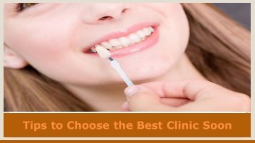 Tips to Choose the Best Clinic Soon
