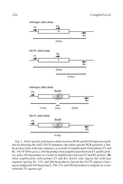 Myeloid Leukemia