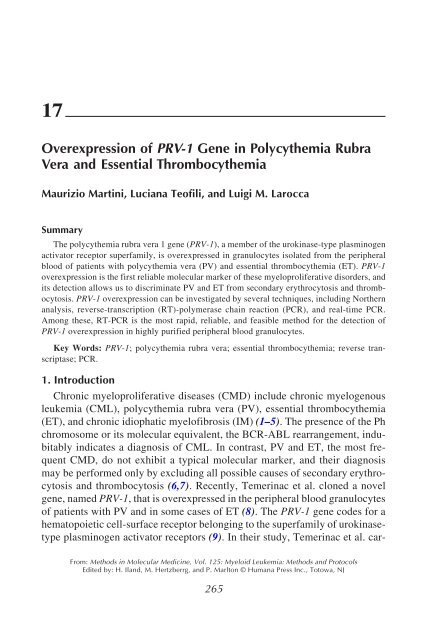 Myeloid Leukemia