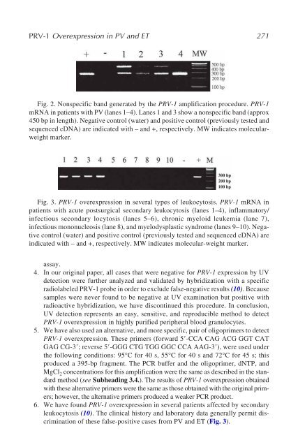 Myeloid Leukemia