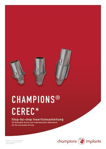 Step-by-Step-Anleitung Champions CEREC