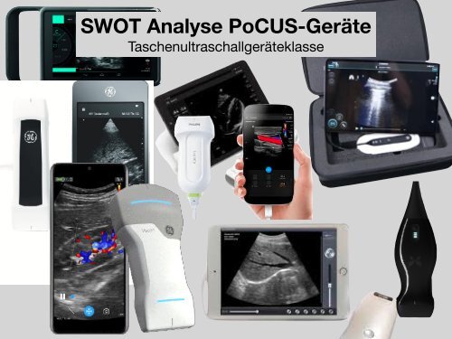 SWOT-Analyse zu "Pocket Ultrasound": Die Meinung von Traditionalisten und PoCUS-Anwendern.