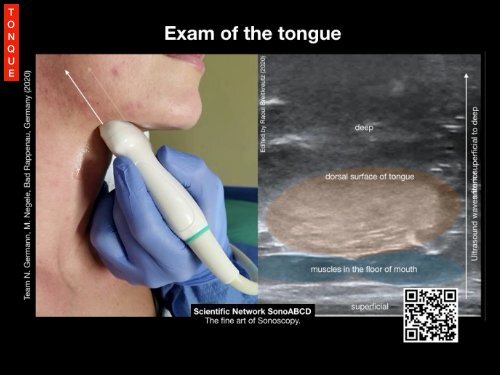 Basics of Anterior and Airway Ultrasound Procedures plus Video Clips