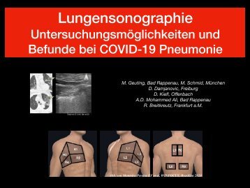 COVID-19 Lungensonographie: Untersuchungsmethoden und Befunde
