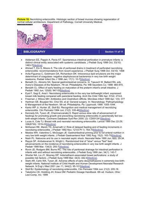 Anemia of Prematurity - Portal Neonatal