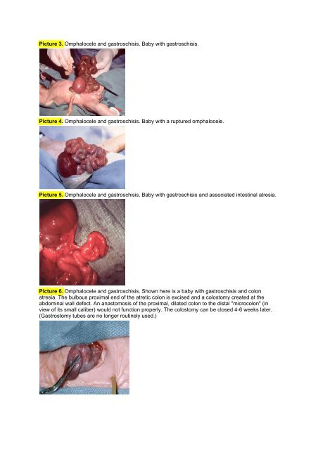 Anemia of Prematurity - Portal Neonatal