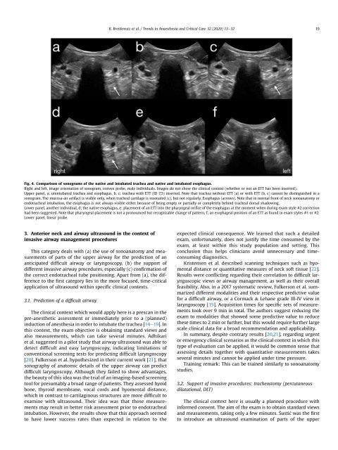 Anterior Neck and Airway Ultrasound - a practical overview.