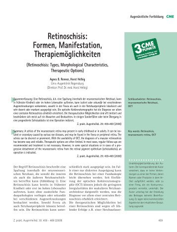 Retinoschisis: Formen, Manifestation, Therapiemöglichkeiten